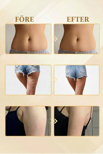 Dräneringsmassage och anti-celluliter